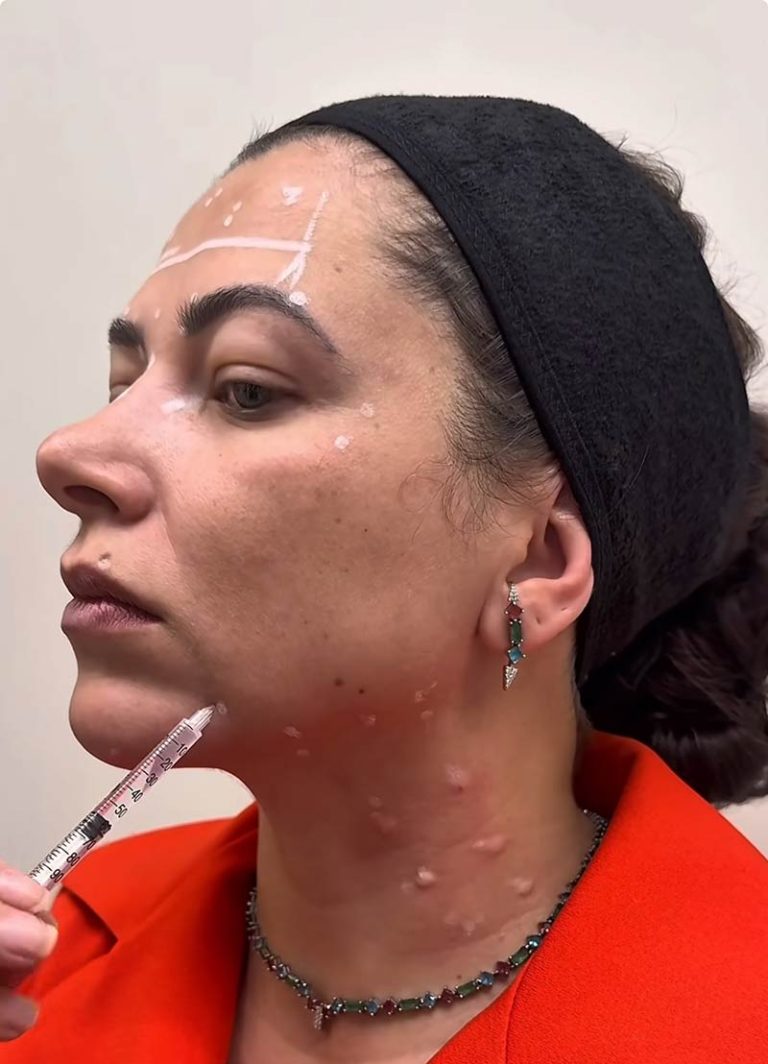 harmonizacao-da-face